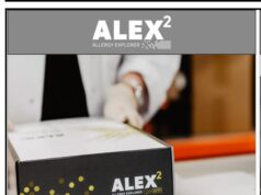 छत्तीसगढ़ का पहला सीआरडी मशीन वृंदा चेस्ट एलर्जी सेंटर में मशीन से टेस्ट कराने पर एलर्जी का चलेगा पता, मिल सकेगी बीमारी से निजात नाक, फेफड़े और त्वचा की एलर्जी का त्वरित इलाज हुआ संभव