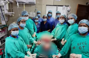 अम्बेडकर अस्पताल में दुर्लभ एवं अपने आप में अनोखी सेकेंडरी एब्डोमिनल प्रेग्नेंसी का सफल ऑपरेशन